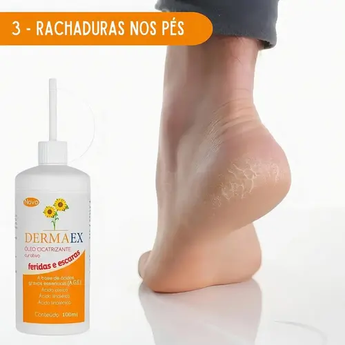 Dermaex Óleo Cicatrizante Almotolia Nutriex 100ml