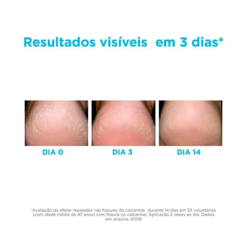 Hidratante para os Pés ISDIN Ureadin Podos 80,25g