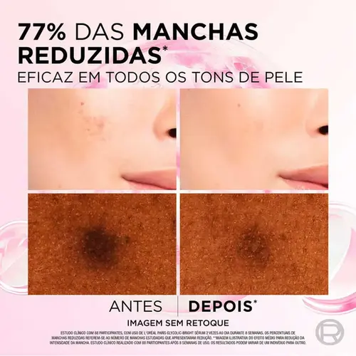 Sérum Facial Anti-Marcas L'oréal Paris Glycolic Bright 30ml