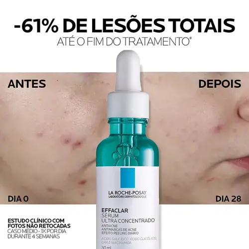 Sérum Facial Antiacne La Roche-Posay Effaclar Ultra Concentrado 30ml